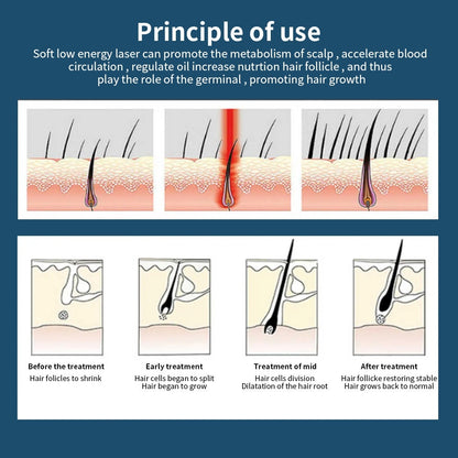 Red Light Hair Growth Cap, Infrared Hair Health Cap, LED